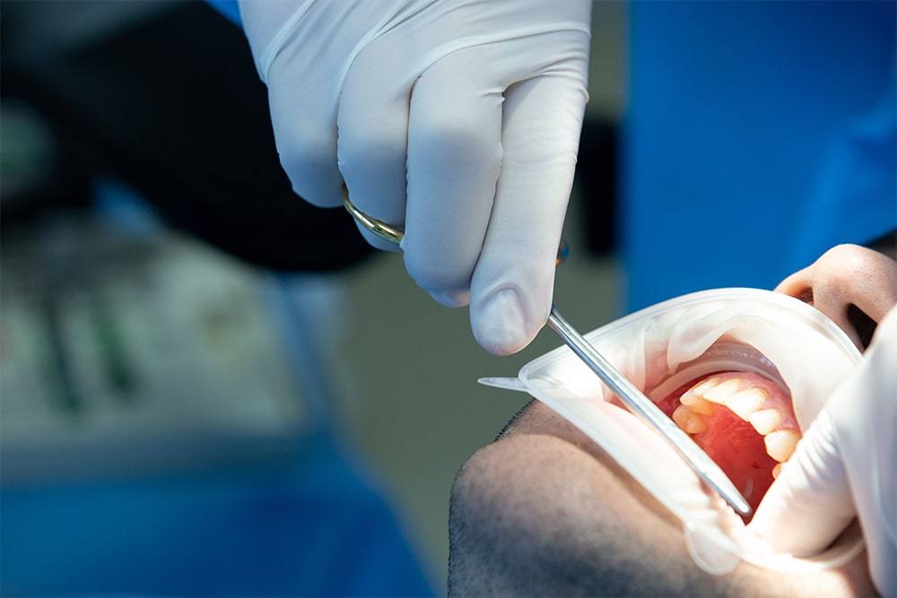 Implante dentário dói - Blog LaserOdonto